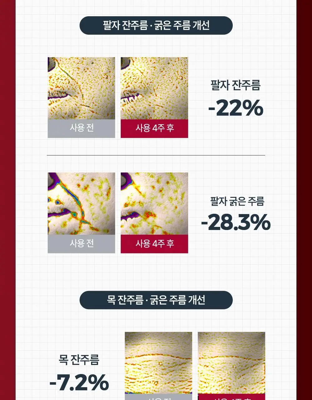 [6주모공세럼] 유세린 하이알루론 3X 컨센트레이트 5ml*6 상세페이지 11